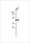 Transcription Factor AP-2 Alpha antibody, 60-705, ProSci, Western Blot image 