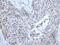 Zinc Finger DHHC-Type Containing 5 antibody, PA5-67578, Invitrogen Antibodies, Immunohistochemistry frozen image 