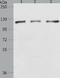 Poly(ADP-Ribose) Polymerase 1 antibody, TA321380, Origene, Western Blot image 