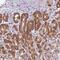 Small Integral Membrane Protein 11A antibody, PA5-62381, Invitrogen Antibodies, Immunohistochemistry paraffin image 