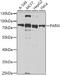 Poly(A)-Specific Ribonuclease antibody, A6941, ABclonal Technology, Western Blot image 
