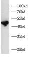 CgA antibody, FNab10750, FineTest, Western Blot image 