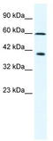 Minichromosome Maintenance Complex Component 7 antibody, TA341688, Origene, Western Blot image 