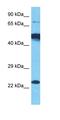 Histone deacetylase 10 antibody, orb327408, Biorbyt, Western Blot image 