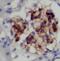 Proteasomal ATPase Associated Factor 1 antibody, FNab06095, FineTest, Immunohistochemistry paraffin image 