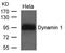 Dynamin-1 antibody, orb43491, Biorbyt, Western Blot image 