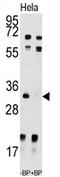 Uridine-Cytidine Kinase 2 antibody, AP13860PU-N, Origene, Western Blot image 