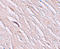 Solute Carrier Family 39 Member 2 antibody, A09140-1, Boster Biological Technology, Immunohistochemistry paraffin image 