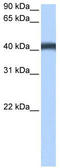 Major Facilitator Superfamily Domain Containing 3 antibody, TA339911, Origene, Western Blot image 