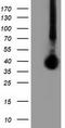 LRAT Domain Containing 2 antibody, TA501920, Origene, Western Blot image 