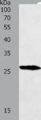 Gremlin 1, DAN Family BMP Antagonist antibody, TA324077, Origene, Western Blot image 
