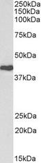 CAK antibody, TA348965, Origene, Western Blot image 