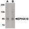 EPH Receptor A10 antibody, PA5-20775, Invitrogen Antibodies, Western Blot image 