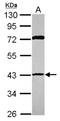 Ribonucleotide Reductase Regulatory TP53 Inducible Subunit M2B antibody, NBP2-19668, Novus Biologicals, Western Blot image 