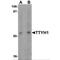 Protein tweety homolog 1 antibody, MBS150115, MyBioSource, Western Blot image 
