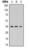 Renin antibody, orb318828, Biorbyt, Western Blot image 