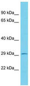 Potassium Channel Tetramerization Domain Containing 2 antibody, TA331957, Origene, Western Blot image 