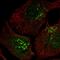 Coiled-Coil Domain Containing 25 antibody, HPA023256, Atlas Antibodies, Immunofluorescence image 