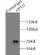 Optineurin antibody, FNab05999, FineTest, Immunoprecipitation image 
