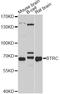 Beta-Transducin Repeat Containing E3 Ubiquitin Protein Ligase antibody, MBS127143, MyBioSource, Western Blot image 