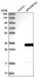 Rho Guanine Nucleotide Exchange Factor 38 antibody, NBP1-93985, Novus Biologicals, Western Blot image 