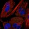 Myotubularin Related Protein 11 antibody, HPA030351, Atlas Antibodies, Immunocytochemistry image 