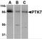 Protein-tyrosine kinase 7 antibody, 4297, ProSci, Western Blot image 
