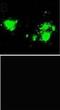 Amyloid Beta Precursor Protein antibody, NBP1-44048, Novus Biologicals, Immunocytochemistry image 