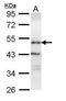 Oxysterol Binding Protein Like 1A antibody, PA5-21860, Invitrogen Antibodies, Western Blot image 