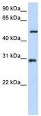Zinc Finger Protein 138 antibody, TA342441, Origene, Western Blot image 