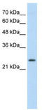 Thyroid Stimulating Hormone Receptor antibody, TA346255, Origene, Western Blot image 