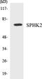 Sphingosine Kinase 2 antibody, EKC1536, Boster Biological Technology, Western Blot image 