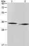 Amidohydrolase Domain Containing 2 antibody, PA5-50321, Invitrogen Antibodies, Western Blot image 