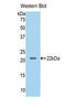 Lecithin-Cholesterol Acyltransferase antibody, LS-C298063, Lifespan Biosciences, Western Blot image 