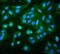 RP2 Activator Of ARL3 GTPase antibody, M01923, Boster Biological Technology, Immunofluorescence image 
