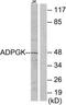 ADP Dependent Glucokinase antibody, TA315868, Origene, Western Blot image 
