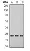 Dicarbonyl And L-Xylulose Reductase antibody, orb340879, Biorbyt, Western Blot image 