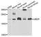 Ubiquitin Conjugating Enzyme E2 F (Putative) antibody, A5160, ABclonal Technology, Western Blot image 