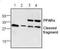 Peroxisome Proliferator Activated Receptor Alpha antibody, GTX44509, GeneTex, Western Blot image 