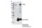 Histone Deacetylase 5 antibody, 98329S, Cell Signaling Technology, Immunoprecipitation image 