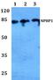 Nephrocystin-1 antibody, PA5-37187, Invitrogen Antibodies, Western Blot image 