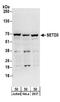 SET Domain Containing 3, Actin Histidine Methyltransferase antibody, A304-072A, Bethyl Labs, Western Blot image 