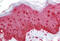 Epithelial splicing regulatory protein 1 antibody, MBS243625, MyBioSource, Immunohistochemistry frozen image 