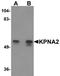 Karyopherin Subunit Alpha 2 antibody, orb75498, Biorbyt, Western Blot image 