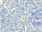 Keratin 14 antibody, A56250-100, Epigentek, Immunohistochemistry paraffin image 