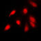p65 antibody, LS-C352781, Lifespan Biosciences, Immunofluorescence image 