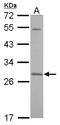 Synaptosome Associated Protein 23 antibody, LS-C155512, Lifespan Biosciences, Western Blot image 