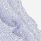 Solute Carrier Family 3 Member 1 antibody, HPA038360, Atlas Antibodies, Immunohistochemistry frozen image 