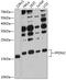 Prefoldin subunit 2 antibody, 14-341, ProSci, Western Blot image 