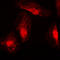 RAN Binding Protein 6 antibody, LS-C353389, Lifespan Biosciences, Immunofluorescence image 